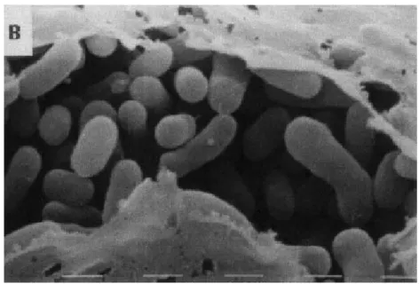 Gambar 2.  Methylobacterium spp  Sumber: http://microbewiki.kenyon.edu/ 