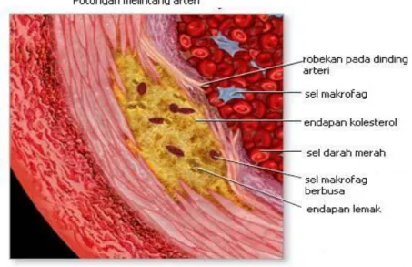 Gambar 2.8  Potongan Melintang Arteri 