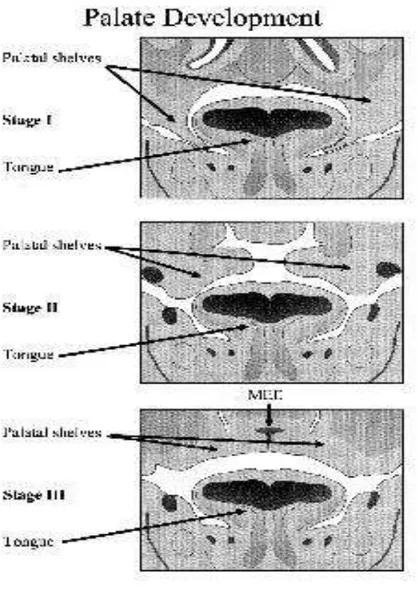 Gambar 4.1 Perkembangan Palate Tahap 1 dan 2 Pada Fetus dengan   Pewarnaan Haematoksilin dan Eosin (Kerrigan et al., 2000)