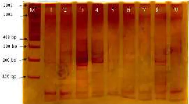 Gambar 3. Hasil  PCR (M:marker,  2:  Kp1,  3:M3, 4:Kp1, 5:Kp1,  6:  B2,  7:J1,  8:B2,  9:B1, 10:N2, 11:B1, 12:J3, 13:M2, 14:M1, 15:P1, 16:J3, 17:N1, 18:P2,  19:M3,  20:M2,  21:P3, 22:P2)