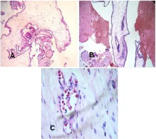 Tabel 1. Distribusi  penderita penyakit trofoblas gestasio- gestasio-nal berdasarkan tipe histopatologi dan kelompok umur