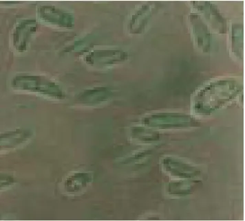 Gambar 15. Makrokonidia F. oxysporum pada Media PDA dengan  pH 2 