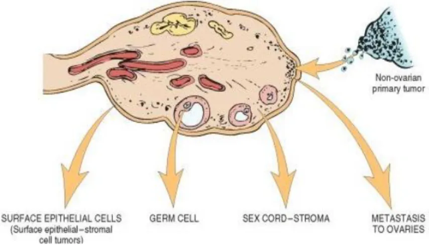 Gambar 2.1 Pembagian tumor ovarium berdasarkan sel asalnya(Kumar  dkk.,2010) 