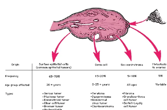Gambar 2.2. Pembagian Tumor Ovarium Menurut Sel Asalnya 3 2.1.3. Faktor Resiko Tumor Ovarium 
