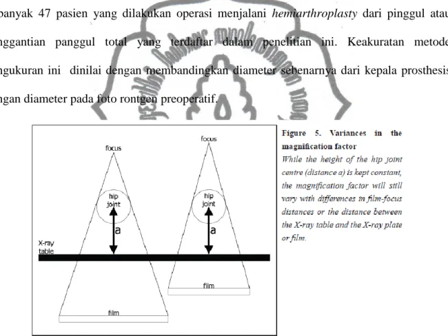 Gambar 2.9.   Variasi faktor magnifikasi berdasarkan height of hip joint . Journal of Digital  Imaging, Vol 20, No 4 December, 2007