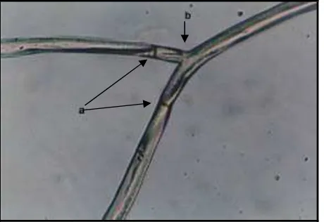 Gambar 8. Struktur Miselia Cendawan Rhizoctonia sp. (a) sekat  atau septa (b)  percabangan 90°
