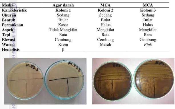 Tabel 2  Koloni bakteri yang tumbuh pada media agar darah dan MCA 