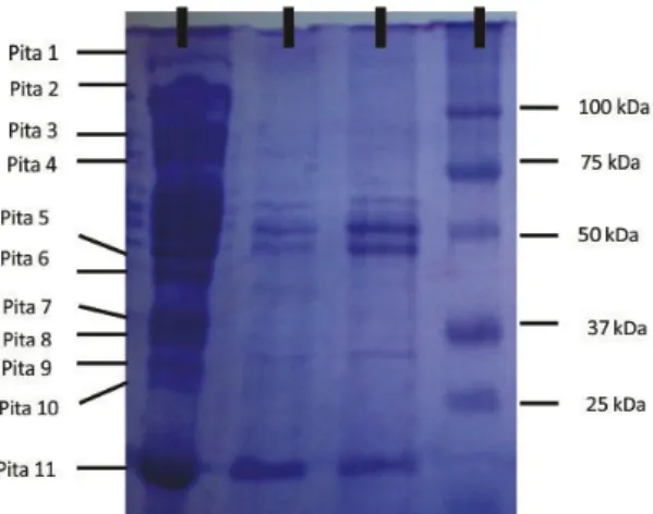 Gambar 2. Hasil elektroforesis pita-pita  protein dengan metode SDS PAGE pada  daging sapi wagyu segar dan direbus
