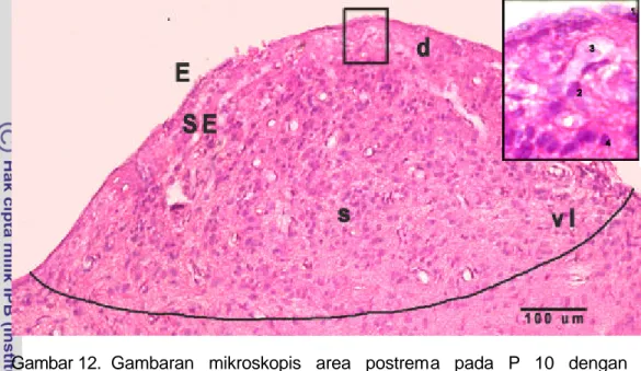 Gambar 12. Gambaran mikroskopis area postrema pada P 10 dengan  pewarnaan HE.  