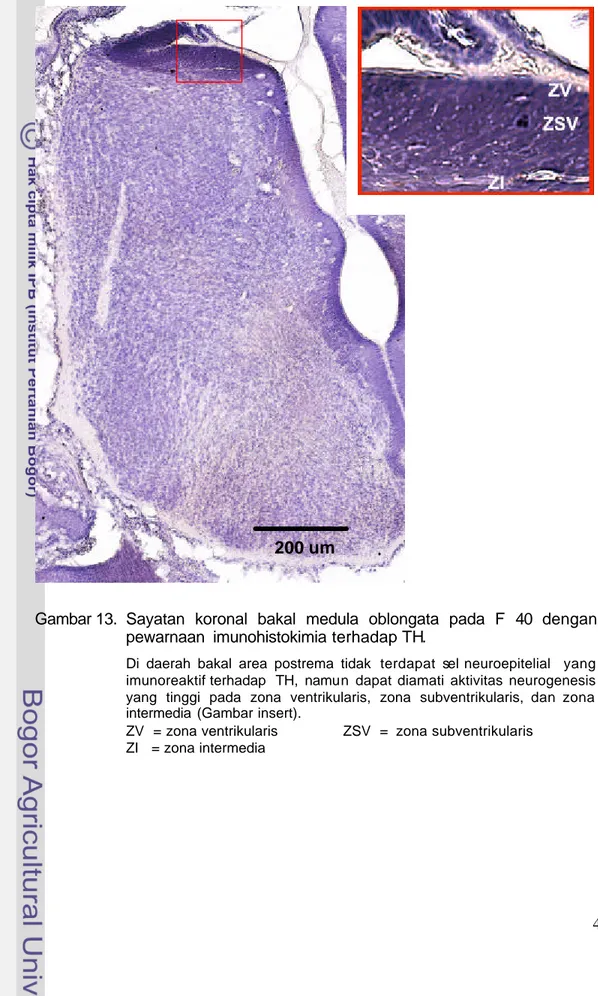 Gambar 13.  Sayatan koronal bakal medula oblongata pada  F 40  dengan  pewarnaan  imunohistokimia terhadap TH