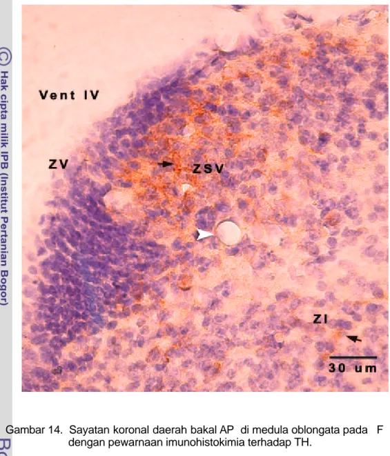 Gambar 14.  Sayatan koronal daerah bakal AP  di medula oblongata pada   F  55  dengan pewarnaan imunohistokimia terhadap TH