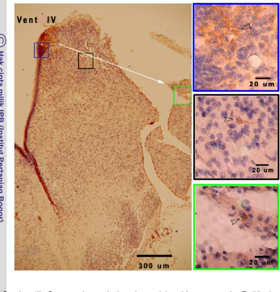 Gambar 17. Sayatan koronal daerah medula oblongata pada F 55 dengan  pewarnaan imunohistokimia terhadap TH