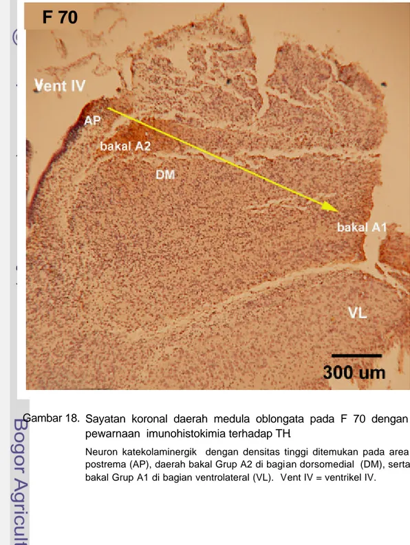 Gambar 18.   Sayatan koronal daerah medula oblongata pada F 70 dengan  pewarnaan  imunohistokimia terhadap TH 