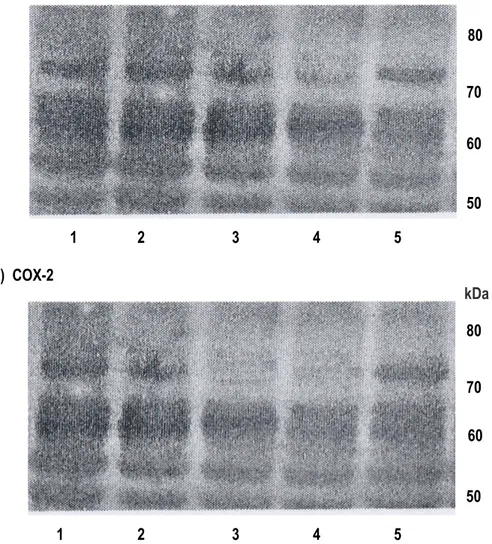 Gambar 1.   Western  blot  dari  polypeptide  COX-1  (A)  dan  COX-2  (B)  dengan  tidak  adanya  (kolom  1)  dan  adanya  bromelain  pada  dosis  10  mg/kg  BB  (kolom  2),  20  mg/kg  BB  (kolom  3)  and  40  mg/kg  BB  (kolom  4)