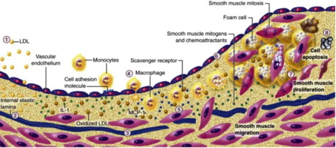 Gambar 1. Patogenesis Aterosklerosis. 