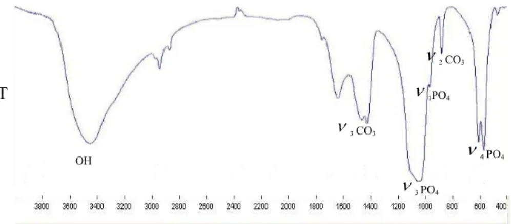 Gambar 3  Spektra FTIR untuk mineral tulang tibia laki-laki usia 37 Tahun. 