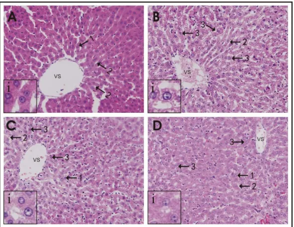Gambar 1.  Gambaran  histopatologi  hepar  tikus  dengan  pewarnaan  HE  (perbesaran 400 kali); (a) kontrol (sehat); (b) hiperkolesterolemia,  (c)  terapi  dosis  400  mg/kg  BB;  dan  (d)  terapi  dosis  800  mg/kg  BB
