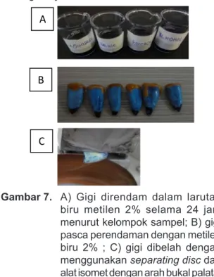 Gambar 7.  A)  Gigi  direndam  dalam  larutan  biru  metilen  2%  selama  24  jam  menurut kelompok sampel; B) gigi  pasca perendaman dengan metilen  biru  2%  ;  C)  gigi  dibelah  dengan  menggunakan separating disc dan  alat isomet dengan arah bukal pal