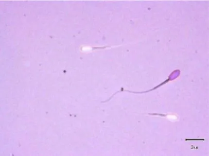 Gambar 3. Spermatozoa Hidupdan  Spermatozoa Mati. 