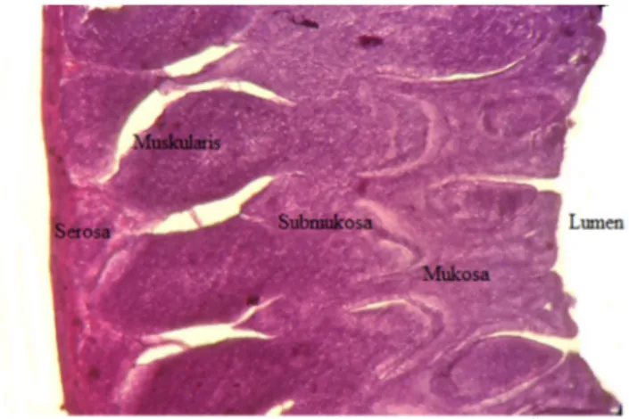 Gambar 2. Struktur Histologi Umbai Cacing  (Perbesaran Mikroskop 40x10) 