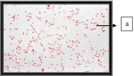 Gambar 1. Hasil pengecatan Gram Isolat PH A3y tampak bakteri berbentuk coccobasil dan berwarna merah (a)