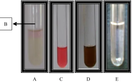 Gambar 4.  Hasil pada uji indol, methyl red, Voges-Proskauer, dan sitrat. (A )Uji indol, (B) Terbentuk cincin merah pada uji  Indol, (C) Uji methyl red, (D) Uji Voges-Proskauer, dan (E) uji sitrat