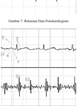 Gambar 8: Rekaman Elektrokardiogram dan Fonokardiogram (1 menyatakan Periode Sistolik, 2 : Periode Diastolik, S1 : Suara satu, S2 : Suara dua, P : Gelombang P, Q, R, S : kompleks QRS, T : gelombang T)