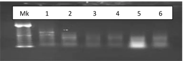 Gambar 6.1  Hasil isolasi total RNA strain M. purpureus ko-kultur  dengan   E. burtonii  (MK : marker (Sharp DNA Ladder Marker), 1: 