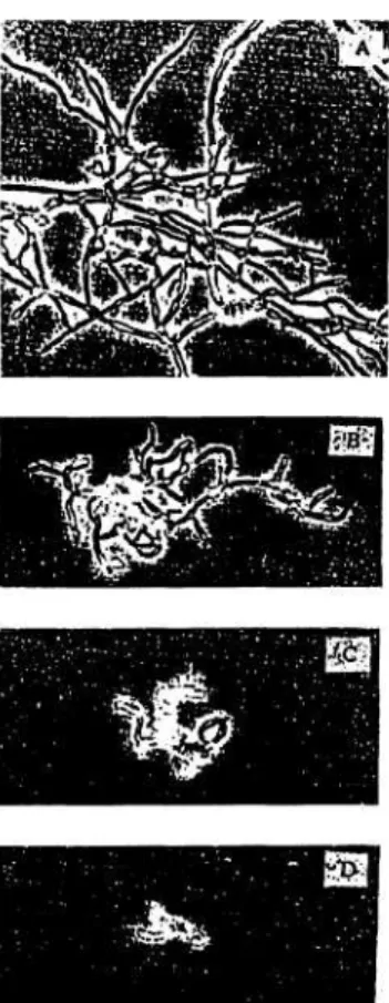Gambar 1. Efek penghambatan hyfa jamur Pyricularia oryzae oleh rhizoxin  (KOBAYASHI et al., 1996)