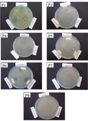 Gambar 2. Diameter Zona Penghambatan Isolat Bakteri Rizosfer Rumput Pangola terhadap Bakteri E