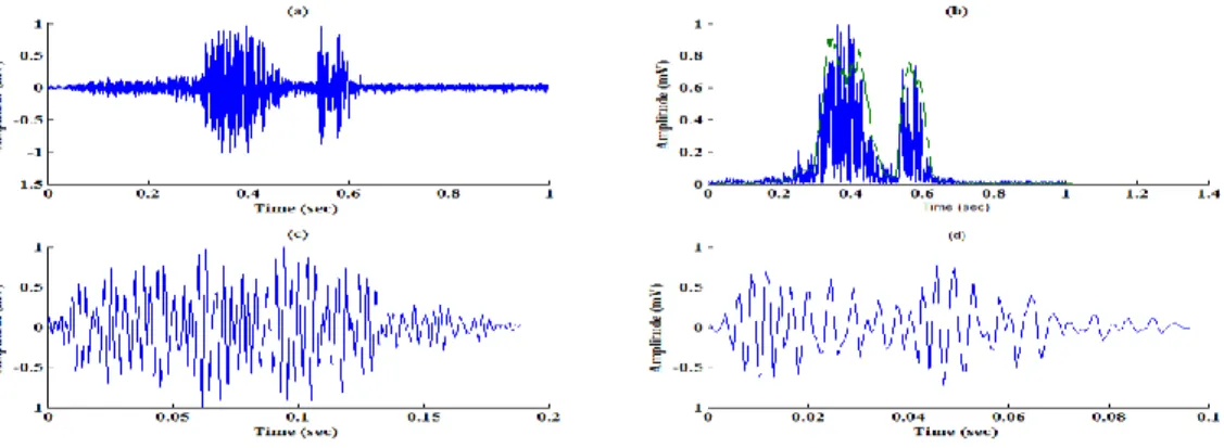 Gambar 6d adalah suara jantung S2. Rata-rata interval  parameter  temporal  dari  hasil  pengujian  6  data  suara  jantung  normal  9  data  atrial  seftal  defect  dan  5  data  Mitral  Stenosis  ditunjukkan  secara  berturut-turut  pada  Tabel 3,4 dan 5