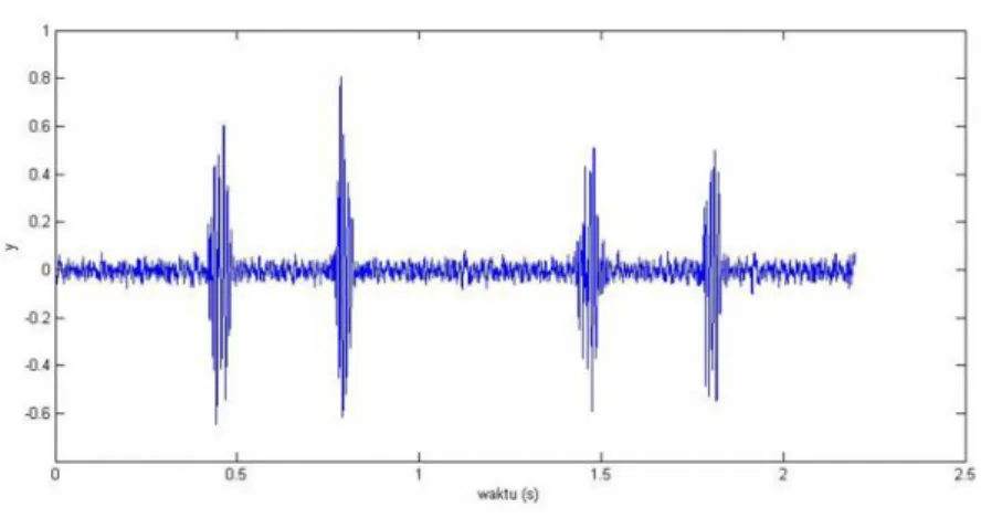 Gambar 2.5. Sinyal suara jantung normal.