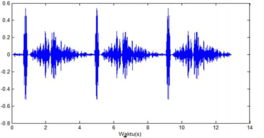 Gambar 2.10. sinyal suara jantung patent ductus arteriosus.