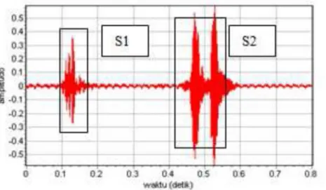 Gambar 2.3. Sinyal suara jantung normal satu siklus (Puspasari dkk, 2012)