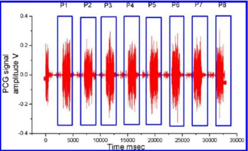 Gambar 2.5. Phonocardiography melacak 8 gelombang S1-S2 berturut-turut (Abbas, 2009)