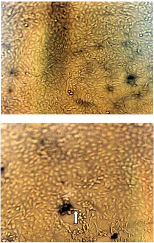 Gambar 2.  Gambaran virus BHV-1 pada biakan sel lestari  (cell line) MDBK dan terlihat awal terbentuknya  CPE pada tanda panah putih 
