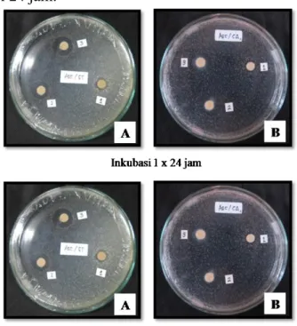 Gambar  3.  Hasil  uji  aktivitas  jamur  simbion  tunikata  Rhopalaea  sp  terdahap  bakteri dan jamur   patogen setelah  di  shaker  selama  7  x  24  jam