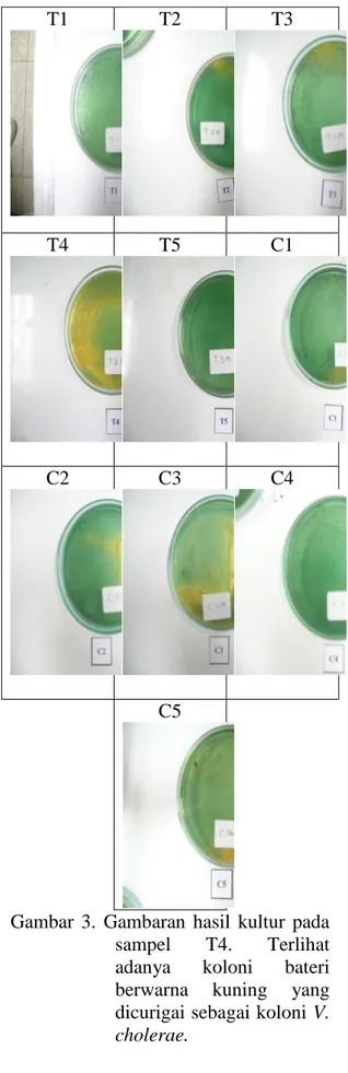 Gambar  3.  Gambaran  hasil  kultur  pada  sampel  T4.  Terlihat  adanya  koloni  bateri  berwarna  kuning  yang  dicurigai sebagai koloni V