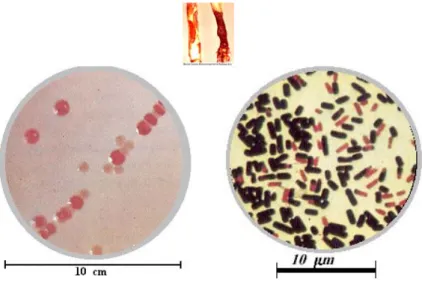 Gambar : Kiri koloni bakteri pada media agar dan kanan sel bakteri gram negatif  (merah), sel bakteri gram positif (ungu) 