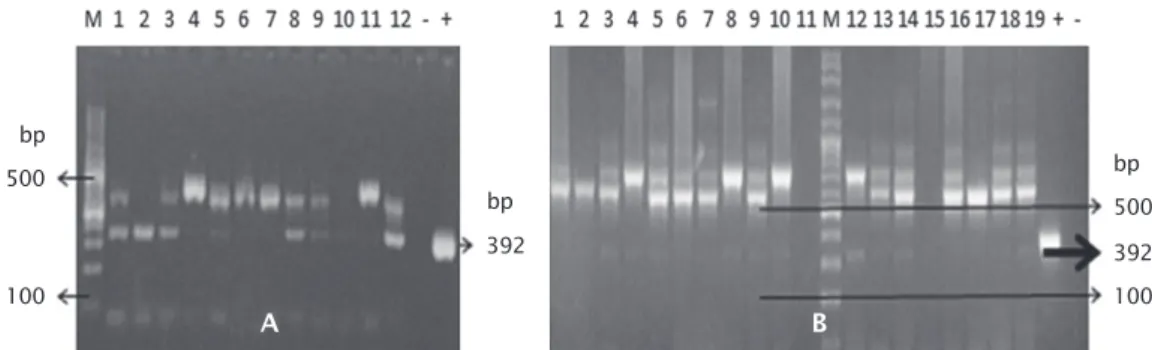 Gambar 1. Deteksi gen PhGH pada gonad dengan menggunakan metode PCR (A. Telur; nomor 1-12 = sel telur, dan (B