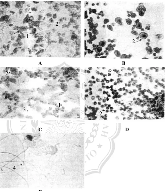 Gambar 1.  Ampus  vagina tikus:  A.  Fase estrus, banyak sel tanduk;  B.  Fase  proestrus,  banyak sel berinti (ovum); C