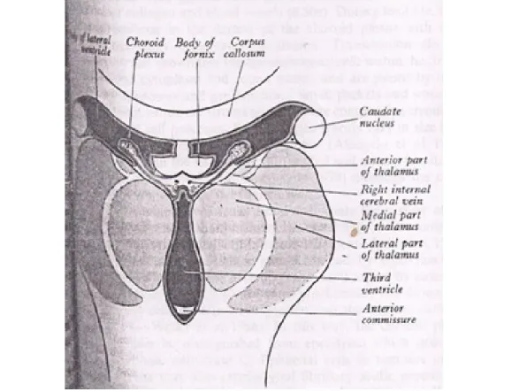 Gambar 1. Potongan koronal dari ventrikulus lateralis dan tertius, tampak  pleksus koroideus