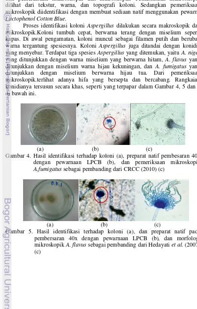 Gambar 4. Hasil identifikasi terhadap koloni (a), preparat natif pembesaran 40x 