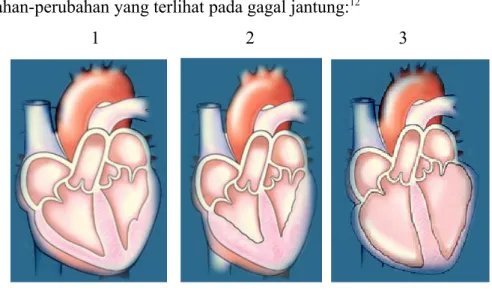 Gambar 1 : Jantung normal.