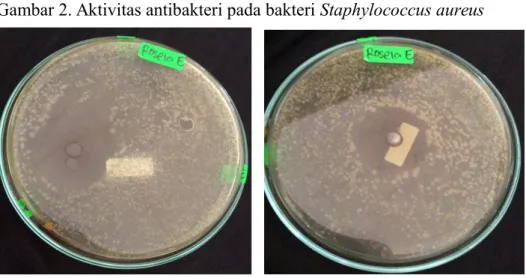 Gambar 3. Aktivitas antibakteri pada bakteri Eschericia coli