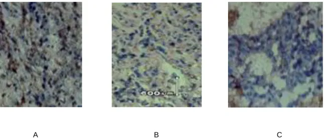 Gambar  2–Efek  pemberian  ekstrak  post  inisiasi  terhadap  ekspresi  protein  COX-2  pada  kanker  payudara