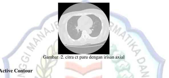 Gambar  2. citra ct paru dengan irisan axial 