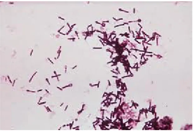Gambar 1. Mikroskopik Clostridium tetani.