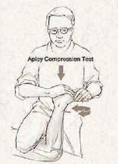 Gambar 8. Pemeriksaan Apley Compresion Test 6. Apley Distraction Test
