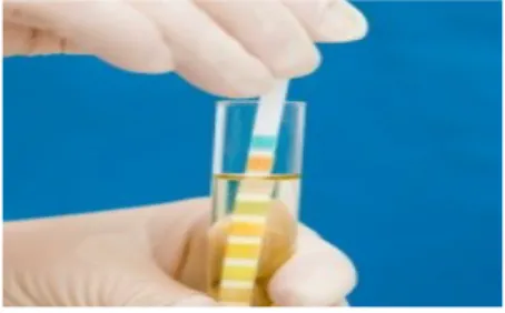 Gambar 1. Pemeriksaan pH urine B. Pemeriksaan Sedimen Urine